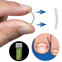 10pcs/box Ingrown Toenail Correction Patch Elastic Patch