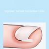 C Shape Ingrown Toenail Correction Liner 10pcs/box